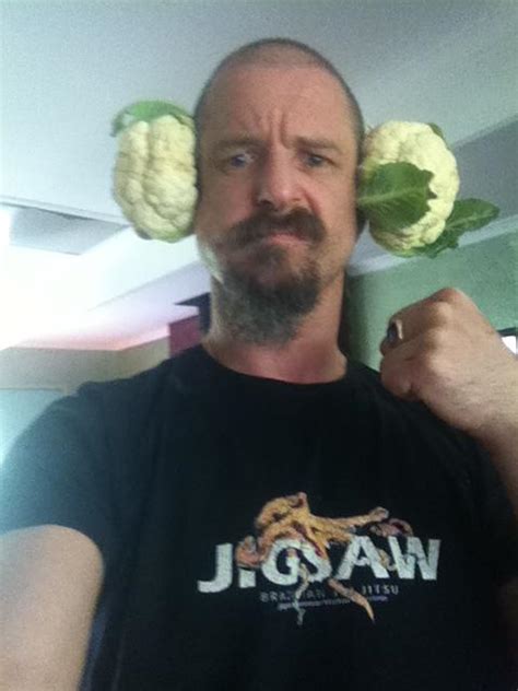 My Opponents Shake With Fear At My Cauliflower Ears Imgur