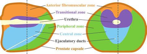 Zonal Anatomy Of The Prostate Parasagittal Left And Transverse Download Scientific Diagram