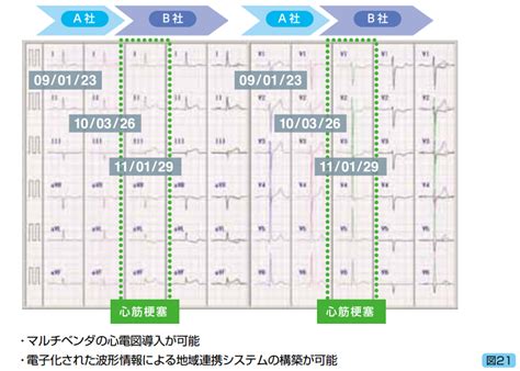 医療情報システム標準化：循環器領域 － Ihe J