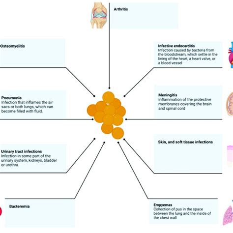 Schematic Examples Of The Types Of Staphylococcus Aureus Infections