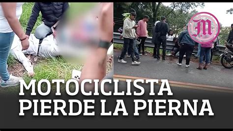 Motociclista Pierde Una Pierna En La M Xico Cuernavaca Youtube