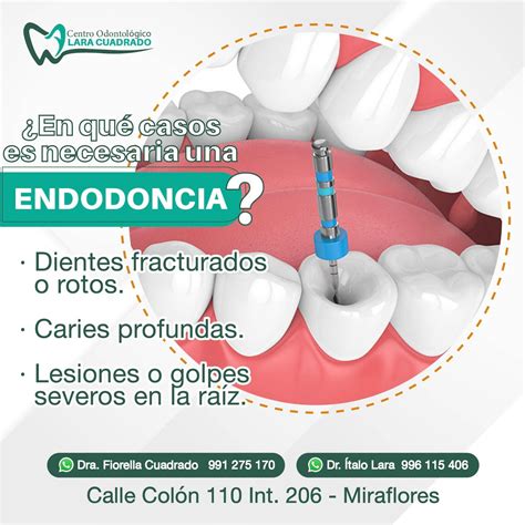 ¿En qué casos es... - Centro Odontológico Lara Cuadrado