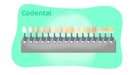 Cores De Resina Para Dentes Tudo Que Voc Precisa Saber