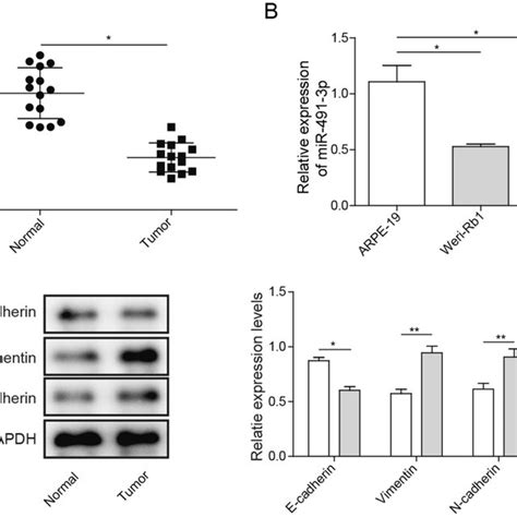 Expression Profiles Of Mir P In Rb Tissues And Rb Cell Lines And