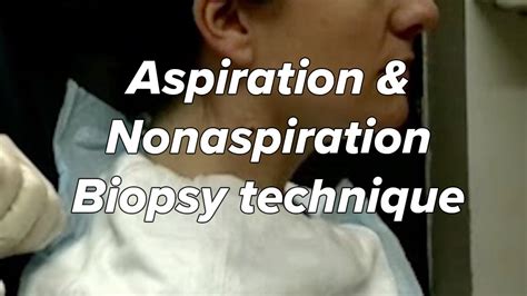 Aspiration And Nonaspiration Zajdela Technique Biopsy Fine Needle Neck Mass Youtube