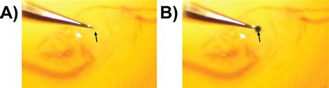 Microinjection Of Recombinant Rcas A Retrovirus Into Embryonic Chicken