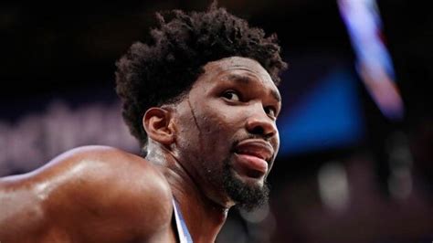 76ers Joel Embiid Undergoes Surgery No Timetable Set For Return Cbc