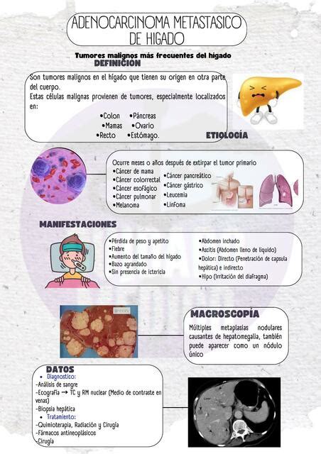 ADENOCARCINOMA METASTÁSICO DE HÍGADO CUIDADO MEDICO uDocz