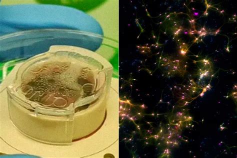 Human Brain Cells Teach Themselves How To Play Pong In Petri Dish