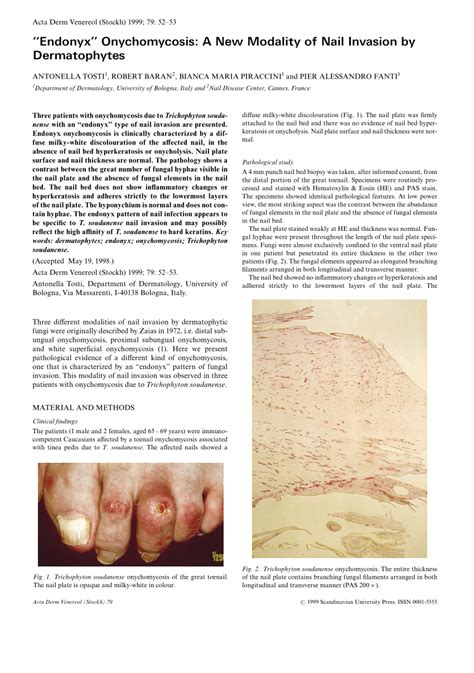 Pdf Endonyx Onychomycosis A New Modality Of Nail Invasion By Dermatophytes