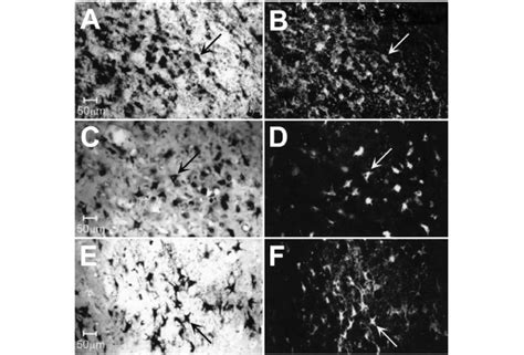 Photomicrographs Obtained From The Thalamic VLN Showing Representative