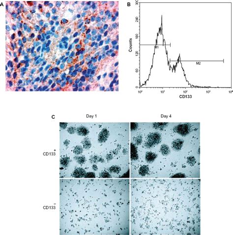 Cancer Stem Cells Cd133 Tumor Cells Show Marked Stem Cell Features