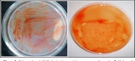 Figure 1 from EXTREMELY HALOPHILIC ARCHAEA FROM ALGERIAN SALT LAKES ...