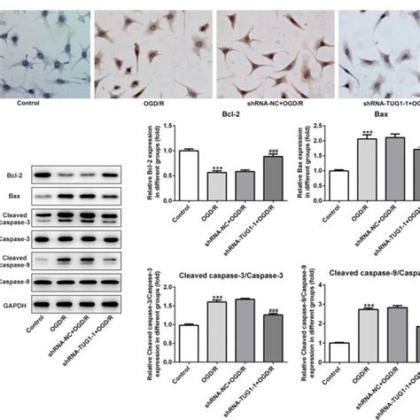 Tug Silencing Suppressed Ogd R Induced Apoptosis In Hk Cells A