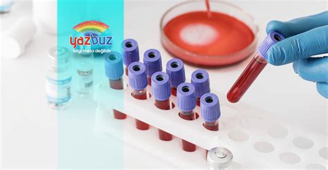 Ferritin Nedir Yazbuz