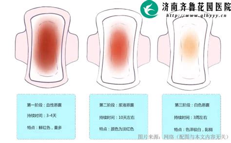 如何从恶露情况来判断自己产后是否正常济南齐鲁花园医院