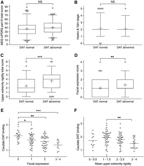 Group differences (a–d) and the effects of hypomimia and increasing ...