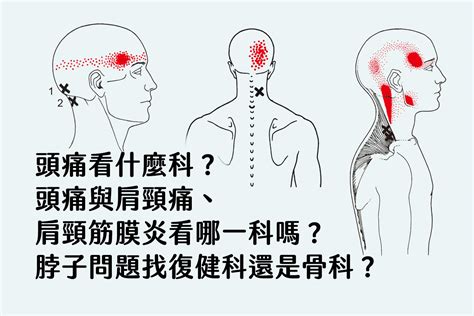 頭痛看什麼科？你知道頭痛與肩頸痛、肩頸筋膜炎看哪一科嗎？脖子問題找復健科還是骨科？ 床墊、睡眠與家具，班尼斯提供科學、設計的全面深入報導