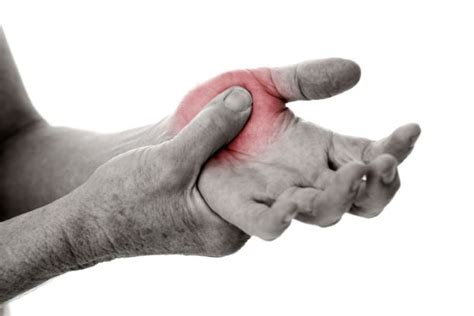 More about arthritic base of thumb pain