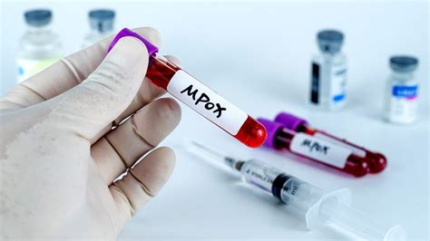 home amref health africa mpox