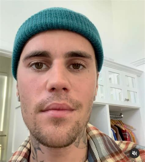 Justin Bieber Suspende Su Gira Debido A Preocupante Par Lisis Facial