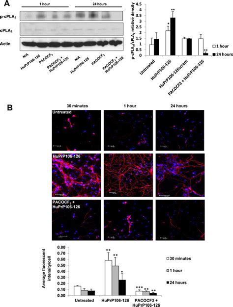 Pacocf Prevents Huprp Induced Cpla Activation A Primary