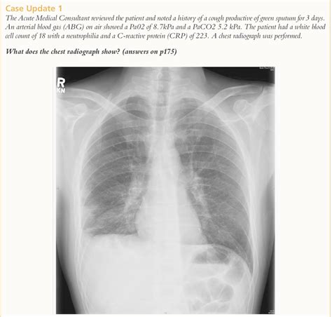 Chest Radiograph On Admission Download Scientific Diagram