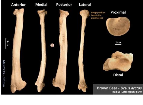 Bones Osteoid Bone Identification