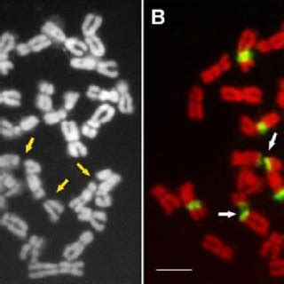 Fluorescence In Situ Hybridization With S Rdna As The Probe Shows