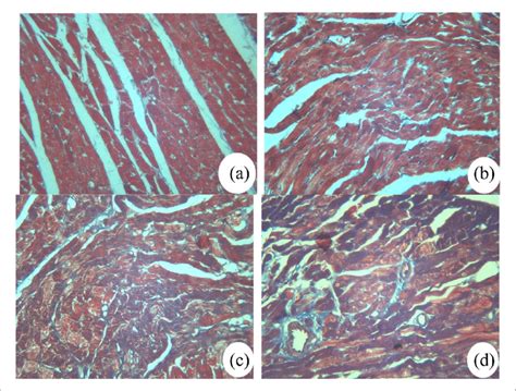 Masson Staining Of Rat Myocardial Tissues In Different Groups Original Download Scientific