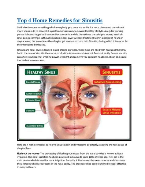 Top 4 Home Remedies For Sinusitis