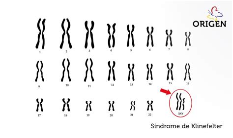 O Que Aneuploidia E Qual A Rela O A Fertilidade Cl Nica