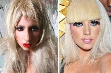 Lady Gaga Plastic Surgery Speculations