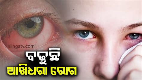 Cases Of Conjunctivitis On Rise Know How To Stay Alert Kalinga Tv