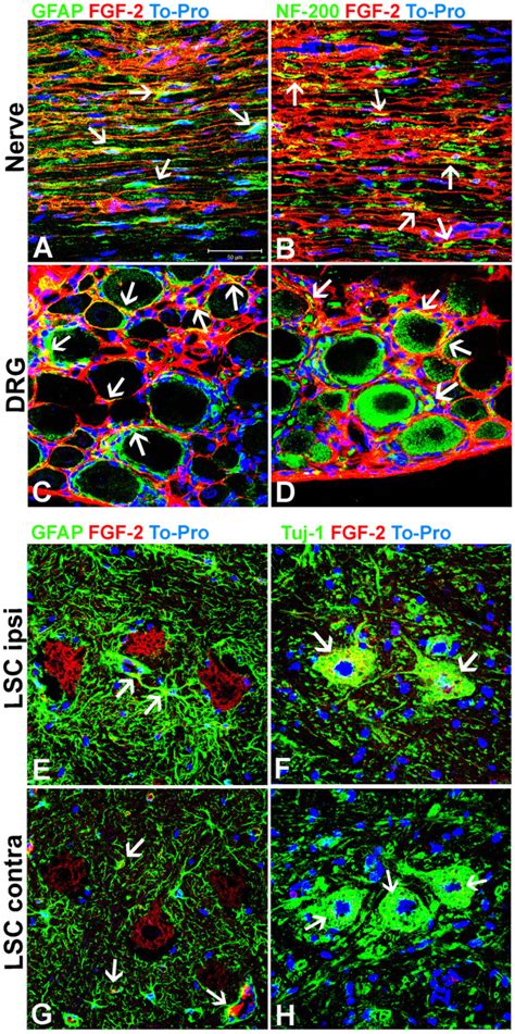 Localization Of Fgf 2 In The Regenerating Nerve Tissue Drg And Lumbar