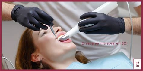 El escaner intraoral 3D Sé Tú Clínica Dental