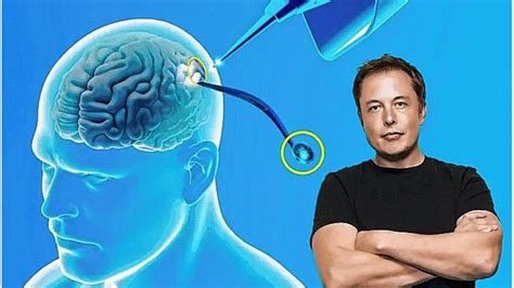 Neurociencia cómo funciona el chip cerebral de Elon Musk