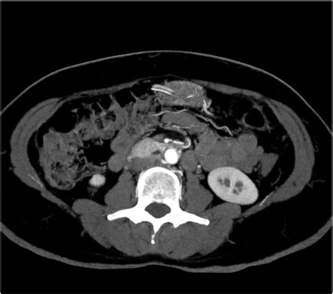 Genitourinary Imaging The Requisites 3e Requisites 10