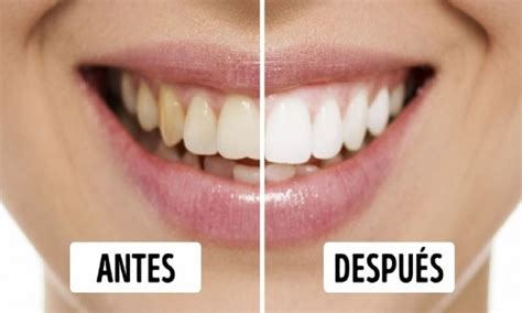 Cómo blanquear los dientes con remedios caseros Revista Digital