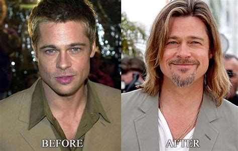 Brad Pitt Plastic Surgery Celebrity Before After Pinterest Eyelid