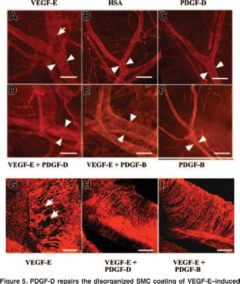 Figure From Pdgf D Induces Macrophage Recruitment Increased