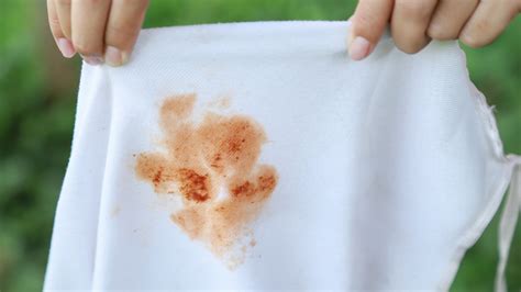 Banish Blood Stains From Clothing With A Simple Item From Your Kitchen