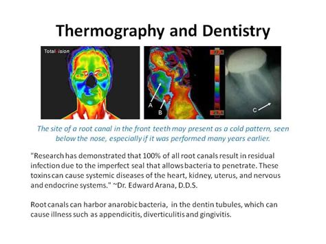 Dental Health Screening | Medical Thermography Associates