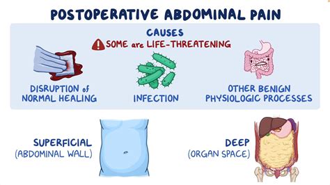 Medical Term For Abdominal Pain At Terrell Moyer Blog