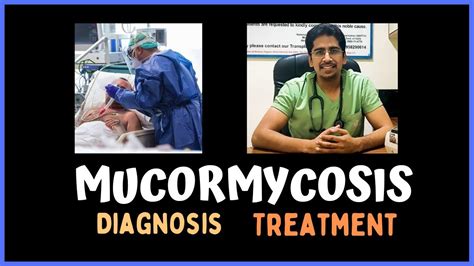 MUCORMYCOSIS Clinical Features Diagnosis Treatment YouTube