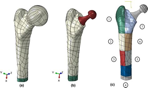 Three Dimensional Models Of The A Intact Femur B Thp And C Gruen