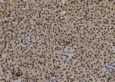 Phospho Sf B Thr Polyclonal Antibody Invitrogen L