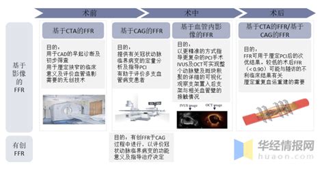 2020年中国血流储备分数（ffr）市场现状分析，未来ffr评价的利用率持续提升「图」 知乎