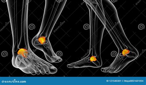 3d rendering of malleolus stock illustration. Illustration of pain ...