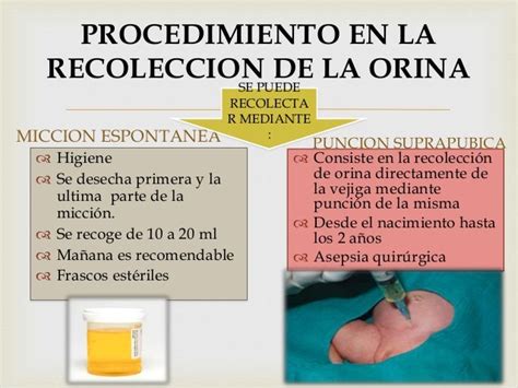 Prueba Orina Y Eces Exposicion